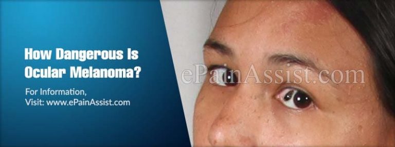 How Dangerous Is Ocular Melanoma & Is It Contagious?