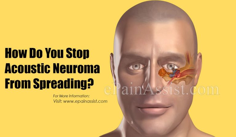 How Do You Stop Acoustic Neuroma From Spreading?
