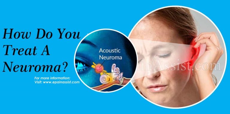 How Do You Treat A Neuroma?