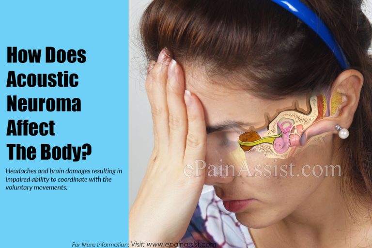 How Does Acoustic Neuroma Affect The Body & What Triggers It?