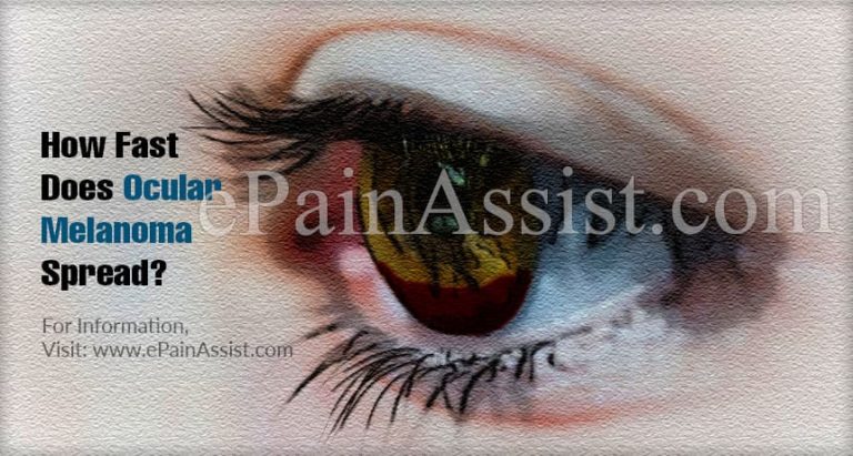 How Fast Does Ocular Melanoma Spread & Does It Spread To The Brain?