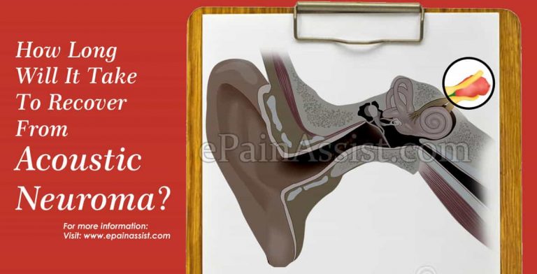 How Long Will It Take To Recover From Acoustic Neuroma & How Long Does The Symptoms Last?