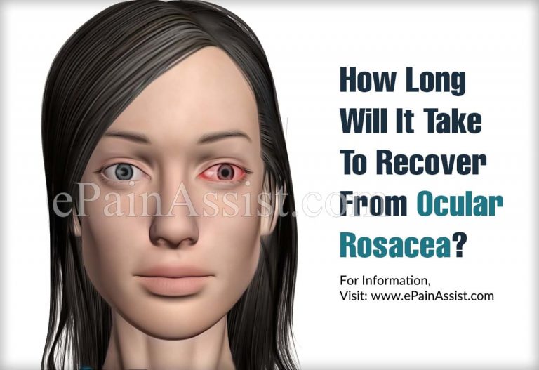 How Long Will It Take To Recover From Ocular Rosacea And How Long Do The Symptoms Last?