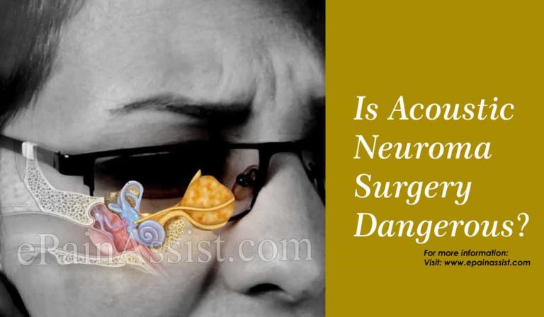 Is Acoustic Neuroma Surgery Dangerous & How Long Is The Surgery?