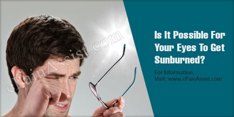 Is It Possible For Your Eyes To Be Sunburned?