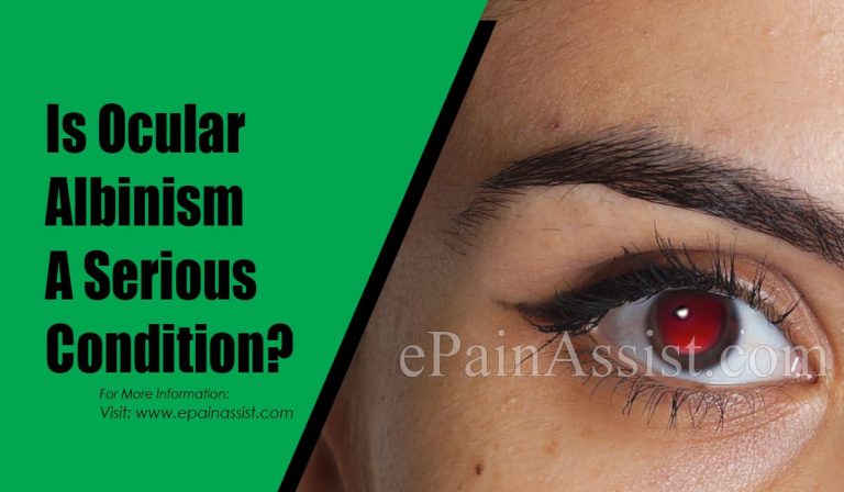 Is Ocular Albinism A Serious Condition & Can It Be Reversed?