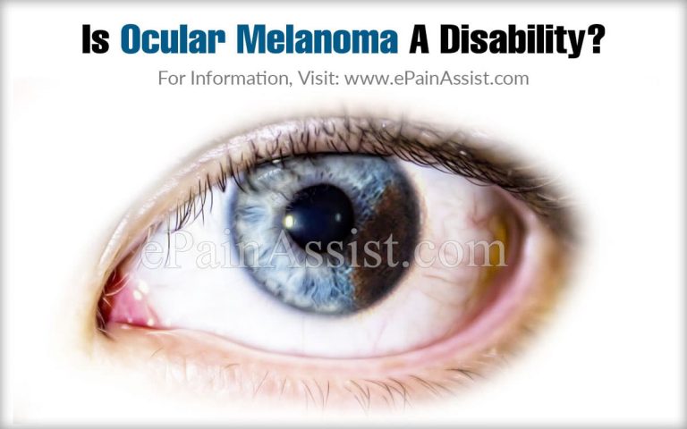 Is Ocular Melanoma A Disability & How Do You Stop It From Spreading?