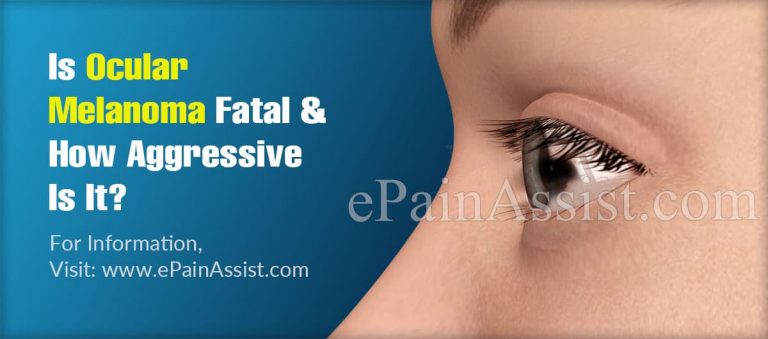 Is Ocular Melanoma Fatal & How Aggressive Is It?