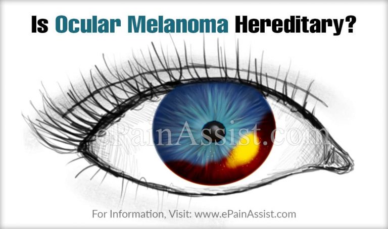 Is Ocular Melanoma Hereditary & Can An Optometrist Detect It?
