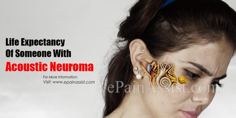 Life Expectancy Of Someone With Acoustic Neuroma