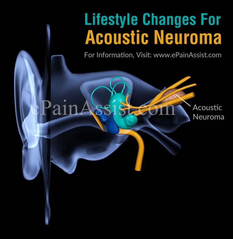 Lifestyle Changes For Acoustic Neuroma