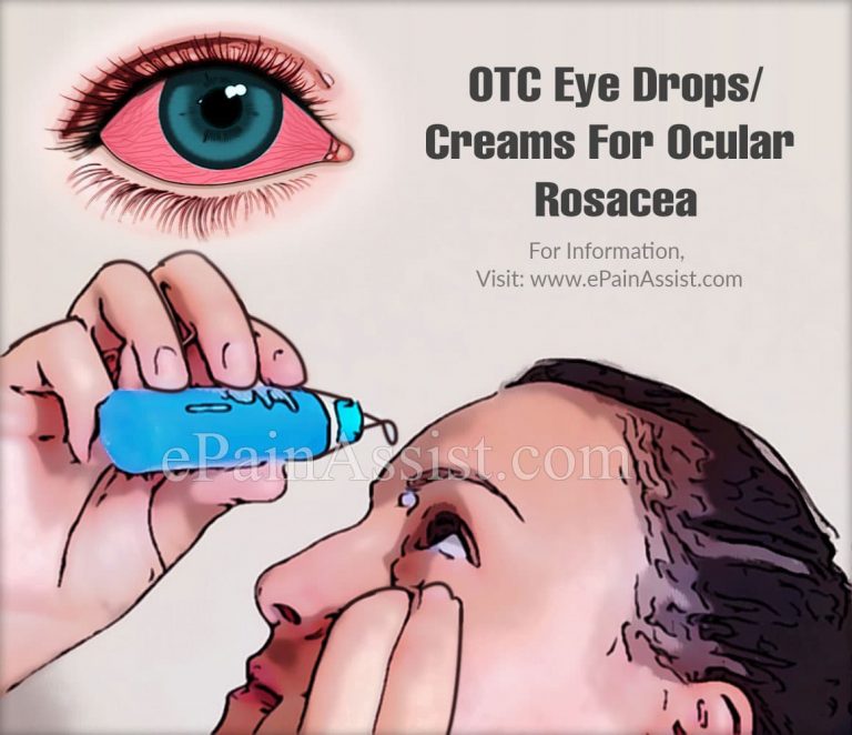 OTC Eye Drops/Creams For Ocular Rosacea