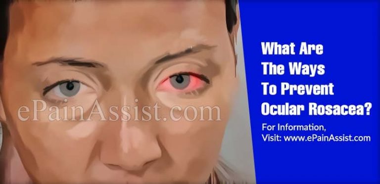 What Are The Ways To Prevent Ocular Rosacea & Does It Reoccur?
