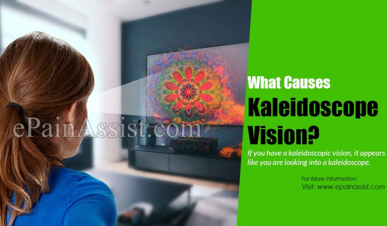What Causes Kaleidoscope Vision