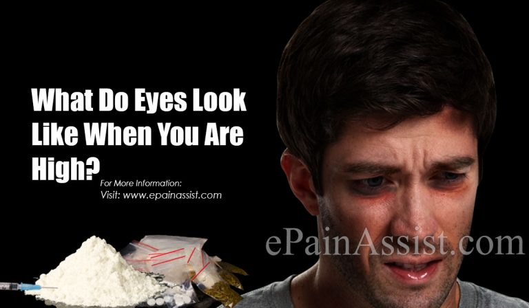 What Do Eyes Look Like When You Are High?
