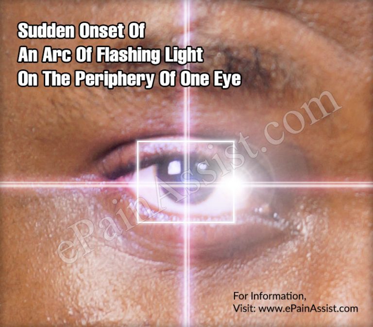 Causes of Sudden Onset Of An Arc Of Flashing Light On The Periphery Of One Eye & Its Prevention