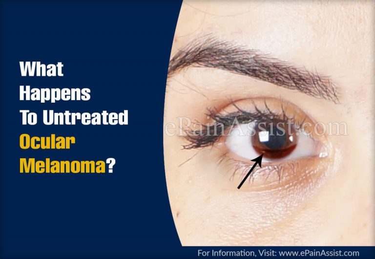 What Happens To Untreated Ocular Melanoma & When To Go To A Doctor For It?