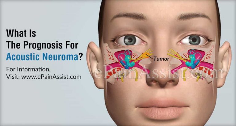 What Is The Prognosis For Acoustic Neuroma & Can It Cause Neck Pain?