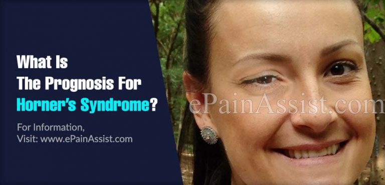 What Is The Prognosis For Horner’s Syndrome & Lifestyle Changes For It?