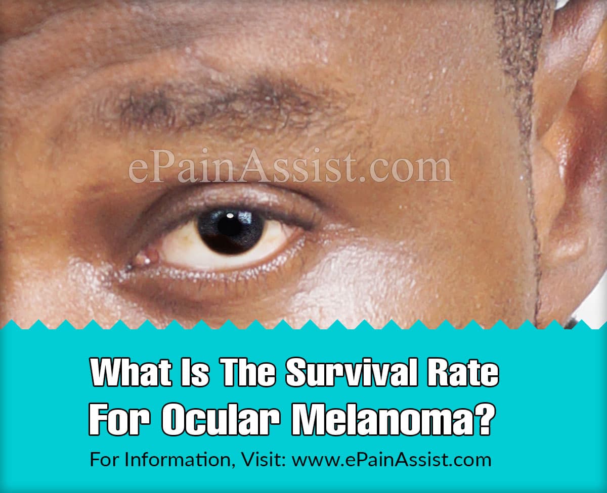 What Is The Survival Rate For Ocular Melanoma? What Is The Survival Rate For Ocular Melanoma?