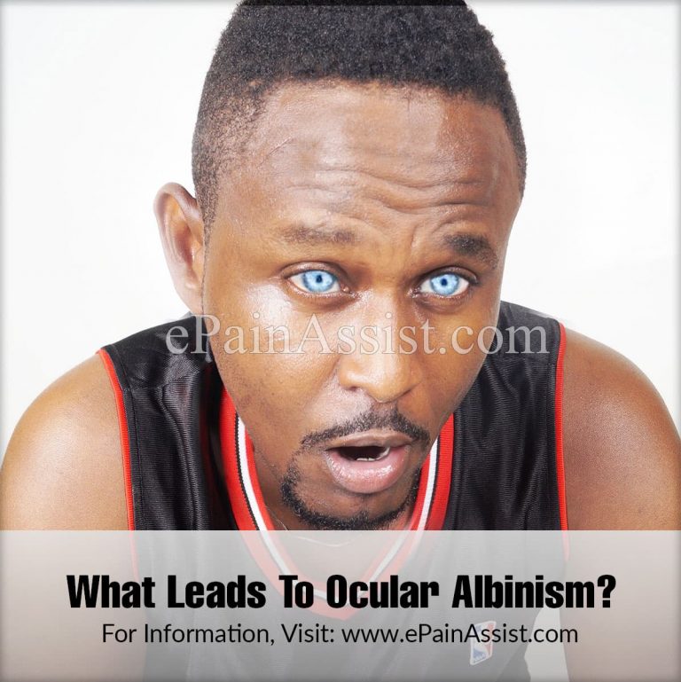 What Leads To Ocular Albinism & Can It Be Cured?