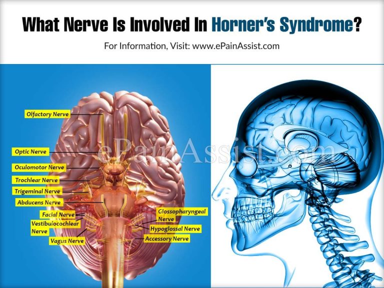 What Nerve Is Involved In Horner’s Syndrome & What Cranial Nerves Are Affected?
