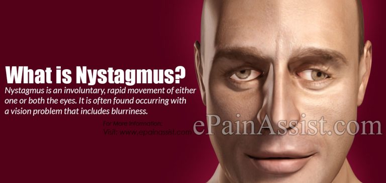 What is Nystagmus & How is it Treated? | Types and Symptoms of Nystagmus