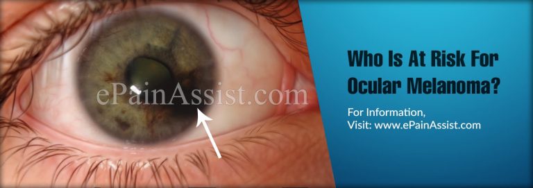 Who Is At Risk For Ocular Melanoma & Is There A Blood Test For It?