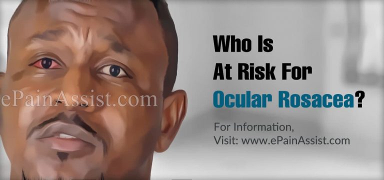 Who Is At Risk For Ocular Rosacea And Is There A Blood Test For It?