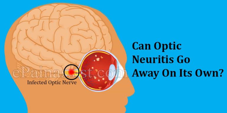 Can Optic Neuritis Go Away On Its Own & What Are Its Natural Remedies?
