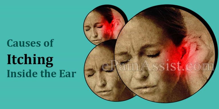 Causes of Itching Inside the Ears & Its Treatment and Home Remedies