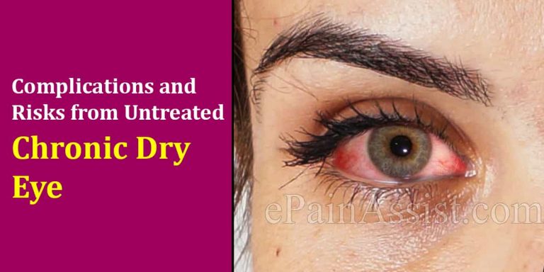 Complications and Risks from Untreated Chronic Dry Eye