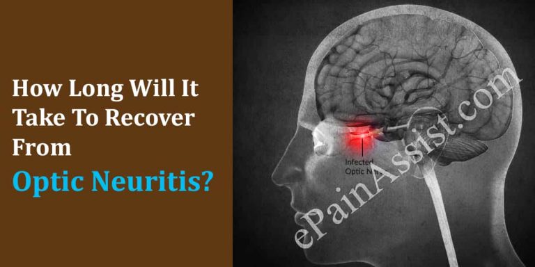 How Long Will It Take To Recover From Optic Neuritis & How Long Does The Symptoms Last?