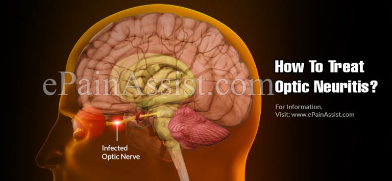 What Are The Ways To Prevent Optic Neuritis & Does It Reoccur?