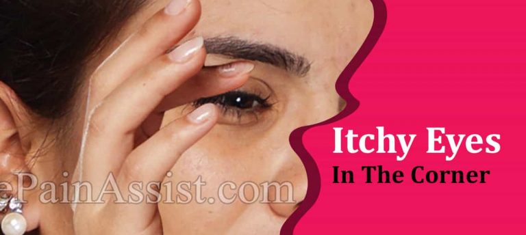 Itchy Eyes In The Corner: Causes, Treatment, Home & Natural Remedies