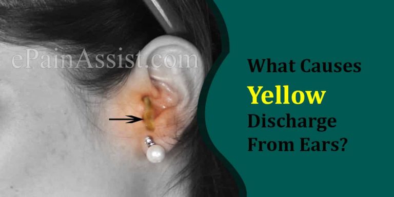 What Causes Yellow Discharge From Ears And What To Do About It?
