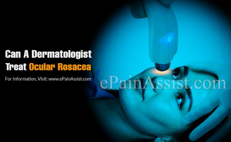Can A Dermatologist Treat Ocular Rosacea & Can You Wear Eye Makeup When You Have It?