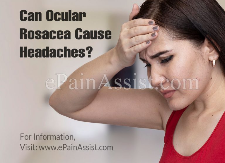 Can Ocular Rosacea Cause Headaches?