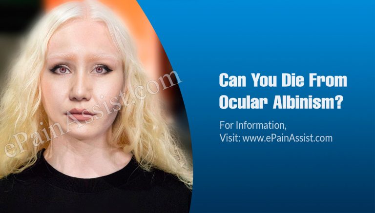 Can You Die From Ocular Albinism & How Do You Stop It From Spreading?