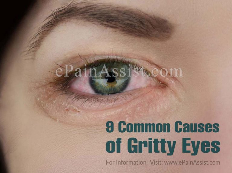 9 Common Causes of Gritty Eyes and What Can Be Done To Treat Them