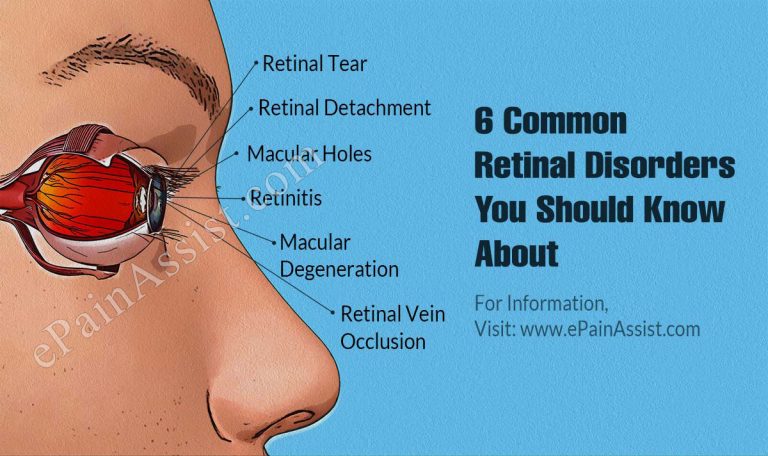 6 Common Retinal Disorders You Should Know About