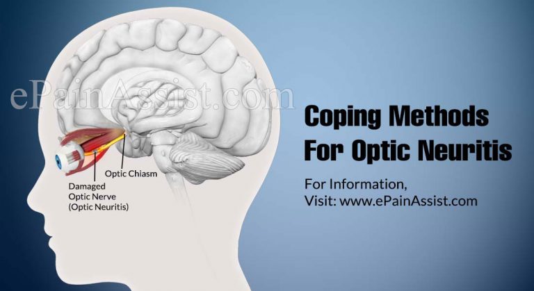 Coping Methods & Home Remedies For Optic Neuritis