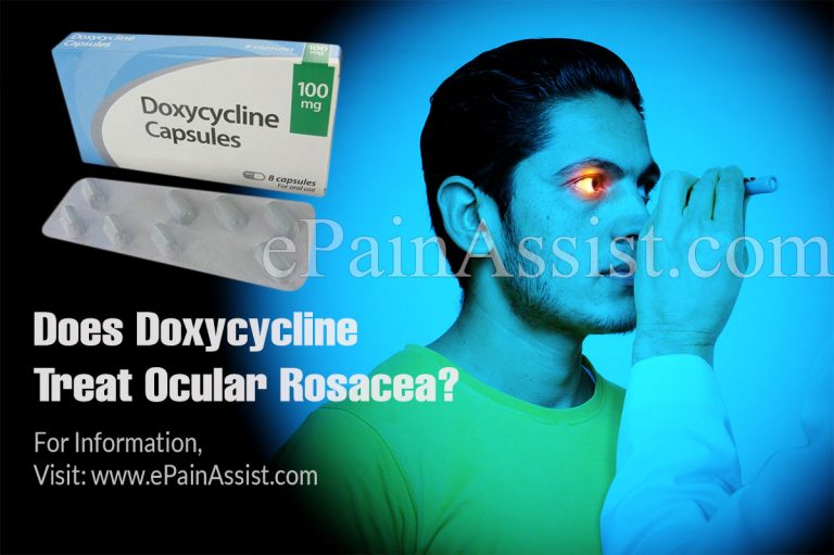 Does Doxycycline Treat Ocular Rosacea & How Long Does It Take To Work?