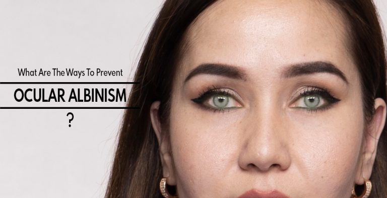What Are The Ways To Prevent Ocular Albinism & Does It Reoccur?