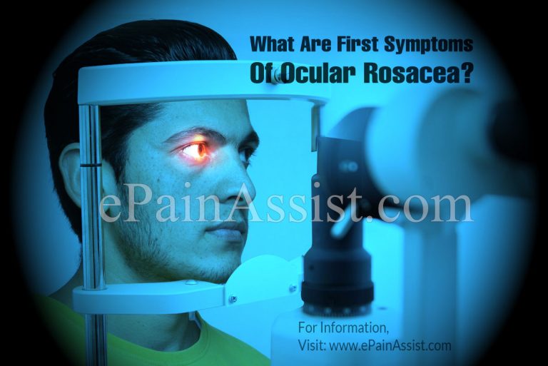 What Are The First Symptoms Of Ocular Rosacea & How Do You Test For It?