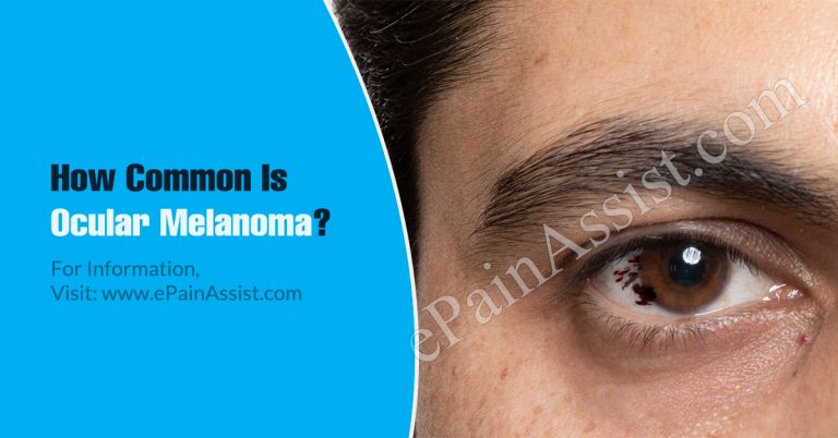 How Common Is Ocular Melanoma Or Is It A Rare Disease?