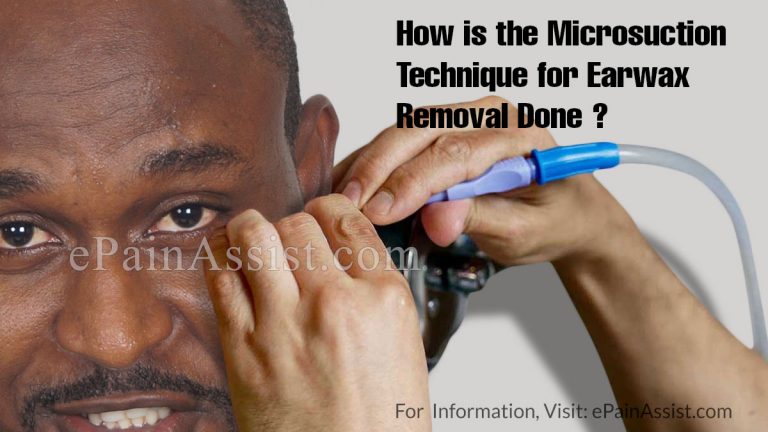 How is the Microsuction Technique for Earwax Removal Done & What are its Benefits & Side Effects?