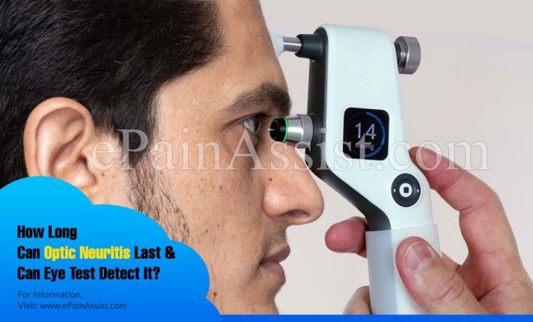 How Long Can Optic Neuritis Last & Can Eye Test Detect It?