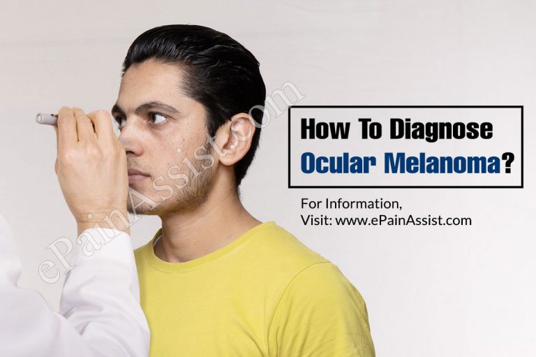 How To Diagnose Ocular Melanoma & What Is The Best Medicine For It?