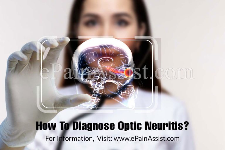How To Diagnose Optic Neuritis & What Is The Best Medicine For It?